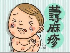 <b><b>惠州哪个医院看荨麻疹</b></b>